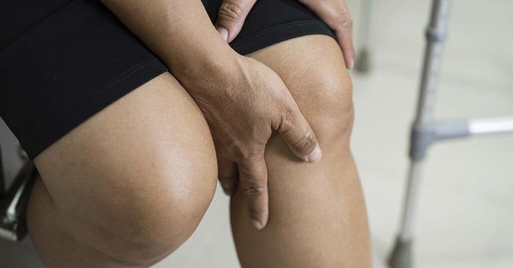 O que é lipedema?